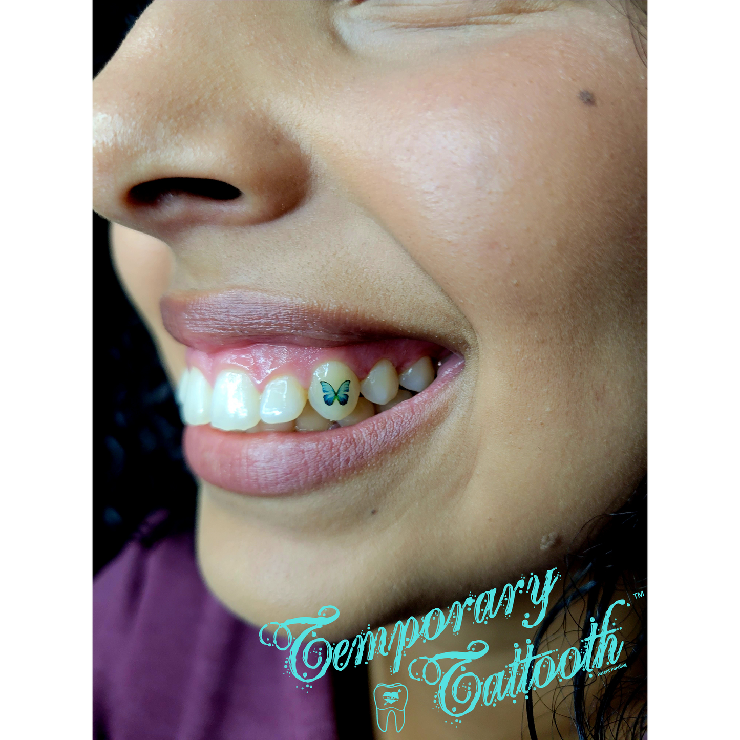 A photo of a butterfly temporary tooth tattoo.  Temporary Tattooths are teeth tattoos that can be removed at anytime.
