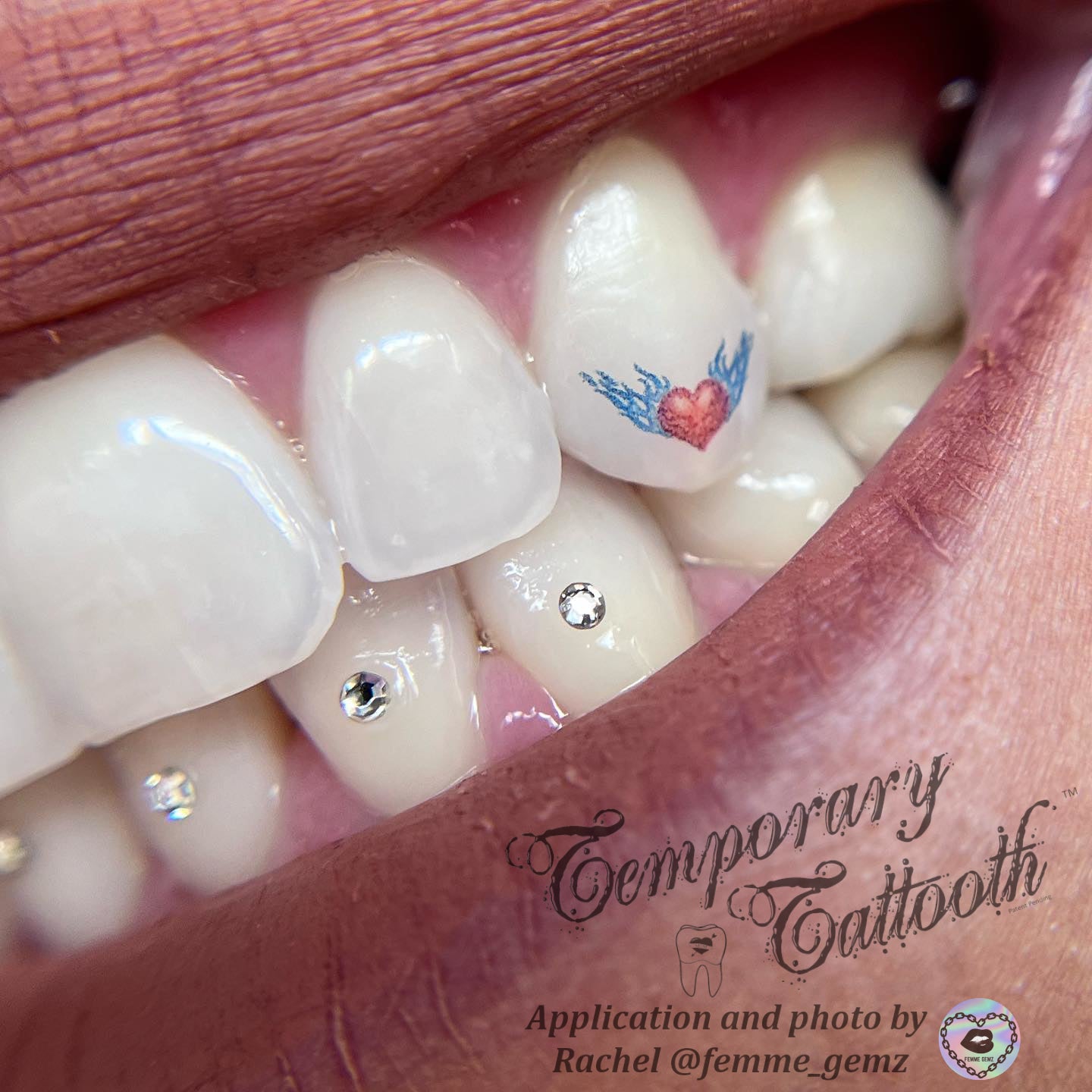 An image of a Tooth Tattoo, or Temporary Tattooth, applied by a professional.  The Temporary tattoo for teeth is of a red heart with wings.