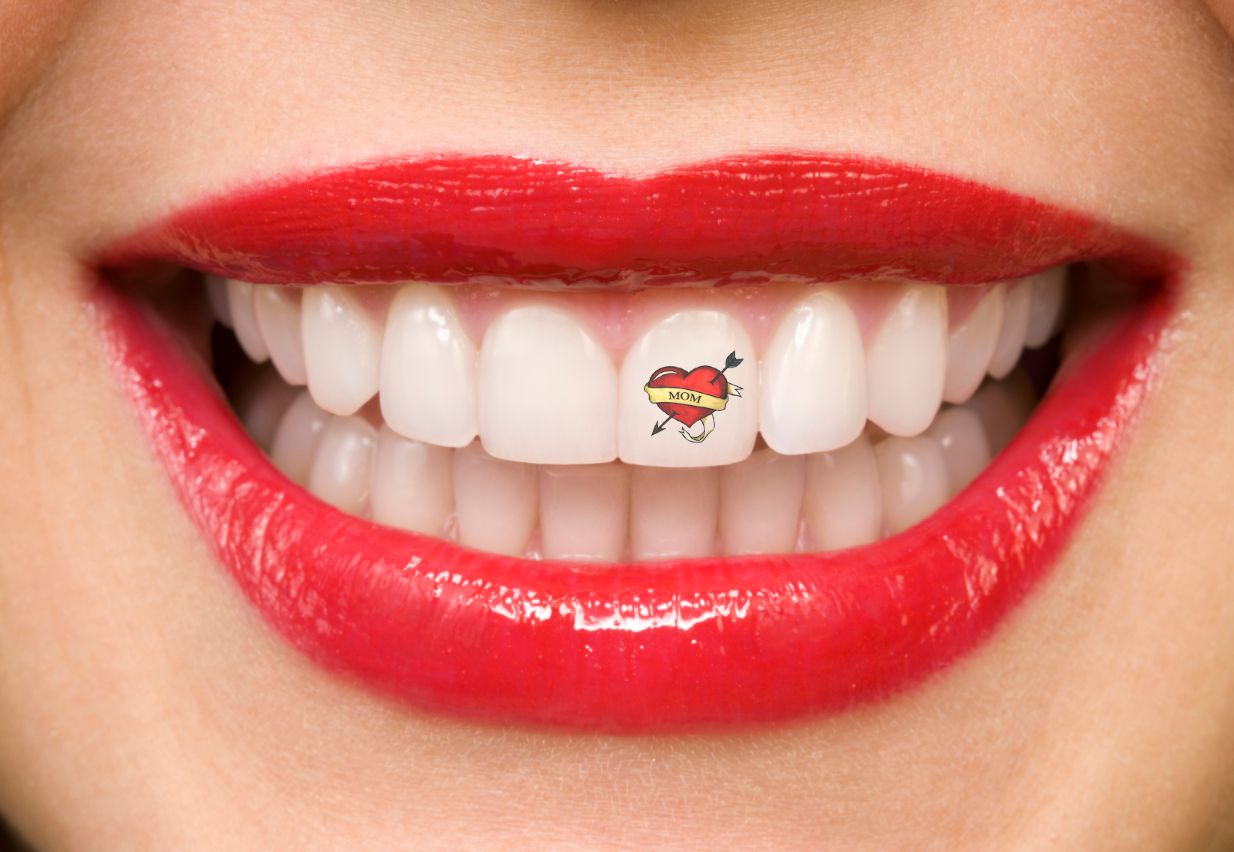A picture of a tooth tattoo, or temporary tattooth.  Teeth tattoos can be applied to any tooth.  Our Tattooths are temporary and easily applied and removed by a licensed dentist.